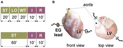 Di-4-ANEPPS Modulates Electrical Activity and Progress of Myocardial Ischemia in Rabbit Isolated Heart